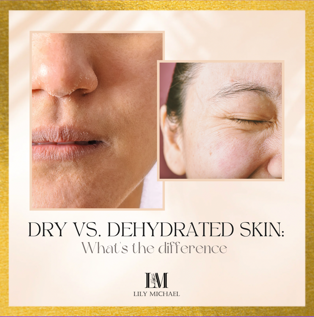 DRY VS. DEHYDRATED SKIN: WHAT’S THE DIFFERENCE (AND HOW TO FIX YOURS)